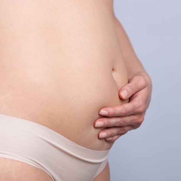 Woman holding her belly that is enlarged due to bloating